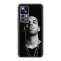 Дизайнерский силиконовый чехол для Xiaomi 12T drake