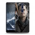 Дизайнерский пластиковый чехол для Nokia 5.1 Бред Питт