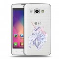 Полупрозрачный дизайнерский пластиковый чехол для LG L60 Единорог