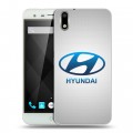 Дизайнерский пластиковый чехол для Ulefone Paris Hyundai