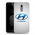 Дизайнерский силиконовый чехол для Umi Super Hyundai