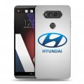 Дизайнерский пластиковый чехол для LG V20 Hyundai