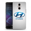 Дизайнерский силиконовый чехол для Doogee Shoot 1 Hyundai