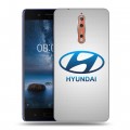 Дизайнерский пластиковый чехол для Nokia 8 Hyundai