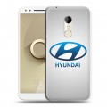 Дизайнерский пластиковый чехол для Alcatel 3 Hyundai