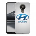Дизайнерский пластиковый чехол для Nokia 3.4 Hyundai