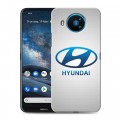 Дизайнерский силиконовый чехол для Nokia 8.3 Hyundai