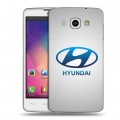 Дизайнерский пластиковый чехол для LG L60 Hyundai