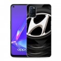 Дизайнерский пластиковый чехол для OPPO A52 Hyundai