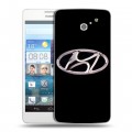 Дизайнерский пластиковый чехол для Huawei Ascend D2 Hyundai