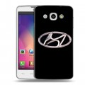 Дизайнерский пластиковый чехол для LG L60 Hyundai