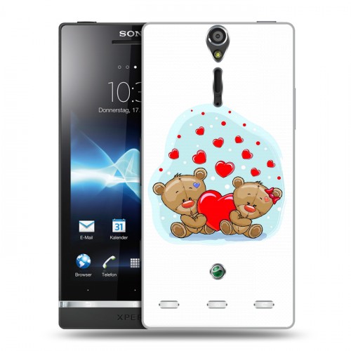 Дизайнерский пластиковый чехол для Sony Xperia S