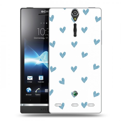 Дизайнерский пластиковый чехол для Sony Xperia S