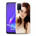 Дизайнерский пластиковый чехол для OPPO A52 Эмма Стоун