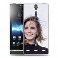 Дизайнерский пластиковый чехол для Sony Xperia S Эмма Уотсон