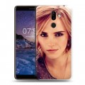 Дизайнерский пластиковый чехол для Nokia 7 Plus Эмма Уотсон