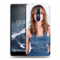 Дизайнерский пластиковый чехол для Nokia 5.1 Эмма Уотсон