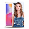 Дизайнерский пластиковый чехол для Xiaomi RedMi 6A Эмма Уотсон