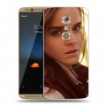 Дизайнерский пластиковый чехол для ZTE Axon 7 Эмма Уотсон