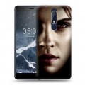 Дизайнерский пластиковый чехол для Nokia 5.1 Эмма Уотсон