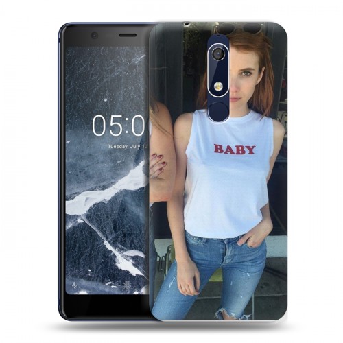 Дизайнерский пластиковый чехол для Nokia 5.1 Эмма Робертс