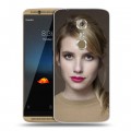 Дизайнерский пластиковый чехол для ZTE Axon 7 Эмма Робертс