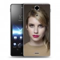 Дизайнерский пластиковый чехол для Sony Xperia TX Эмма Робертс