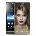 Дизайнерский пластиковый чехол для Sony Xperia S Эмма Робертс