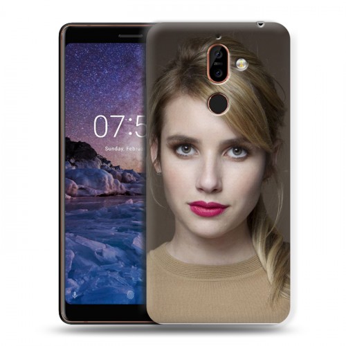 Дизайнерский пластиковый чехол для Nokia 7 Plus Эмма Робертс