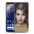 Дизайнерский силиконовый чехол для Nokia 9 PureView Эмма Робертс