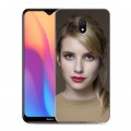 Дизайнерский силиконовый с усиленными углами чехол для Xiaomi RedMi 8A Эмма Робертс