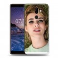 Дизайнерский пластиковый чехол для Nokia 7 Plus Эмма Робертс