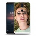 Дизайнерский пластиковый чехол для Nokia 8 Sirocco Эмма Робертс