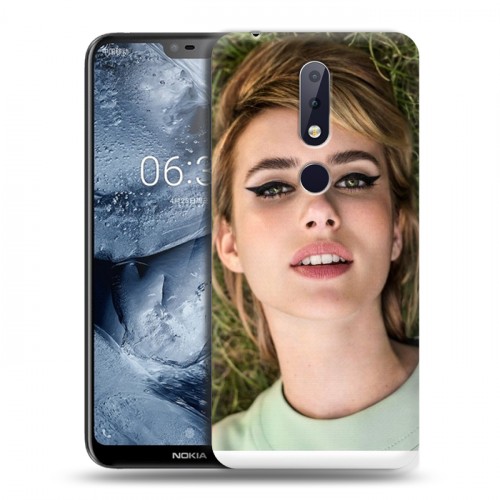 Дизайнерский пластиковый чехол для Nokia 6.1 Plus Эмма Робертс