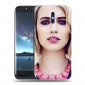 Дизайнерский силиконовый чехол для Doogee BL5000 Эмма Робертс