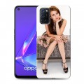 Дизайнерский пластиковый чехол для OPPO A52 Эмма Робертс