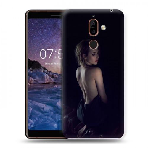 Дизайнерский пластиковый чехол для Nokia 7 Plus Эмма Робертс