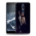 Дизайнерский пластиковый чехол для Nokia 5.1 Эмма Робертс