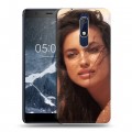 Дизайнерский пластиковый чехол для Nokia 5.1 Ирина Шейк