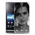 Дизайнерский пластиковый чехол для Sony Xperia S Эмма Уотсон