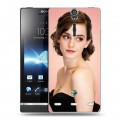 Дизайнерский пластиковый чехол для Sony Xperia S Эмма Уотсон