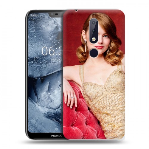 Дизайнерский пластиковый чехол для Nokia 6.1 Plus Эмма Стоун