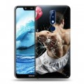 Дизайнерский пластиковый чехол для Nokia 5.1 Plus Бокс