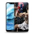 Дизайнерский пластиковый чехол для Nokia 5.1 Plus Бокс