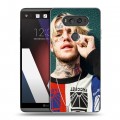 Дизайнерский пластиковый чехол для LG V20  Lil Peep