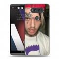 Дизайнерский пластиковый чехол для LG V20 Lil Peep