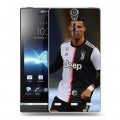 Дизайнерский пластиковый чехол для Sony Xperia S