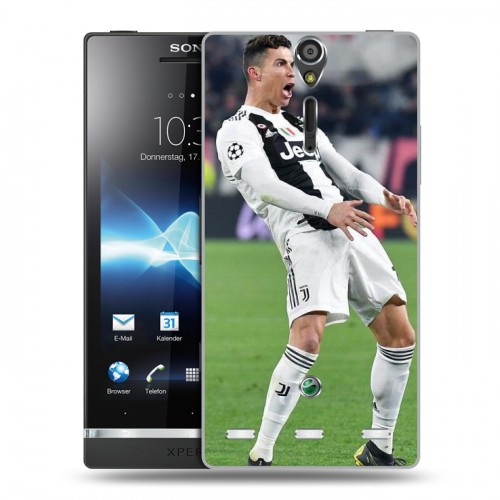 Дизайнерский пластиковый чехол для Sony Xperia S