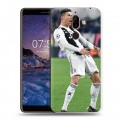 Дизайнерский пластиковый чехол для Nokia 7 Plus