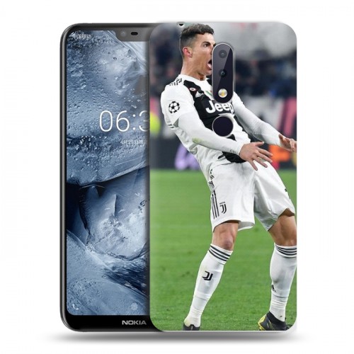 Дизайнерский пластиковый чехол для Nokia 6.1 Plus